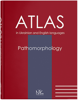 

Патоморфологія = Pathomorphology : атлас укр. та англ. Мовами. Боднар Я. Я., Багрій М. М., Зербіно Д. Д. та інші