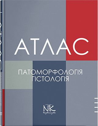 

Патоморфологія та гістологія. Зербіно Д.Д., Багрій М.М., Боднар Я.Я.