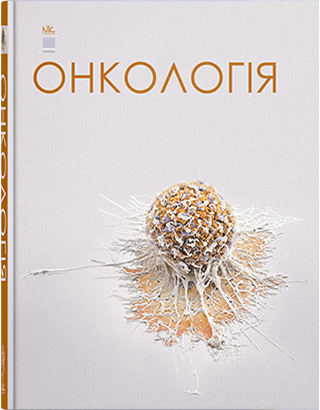 

Онкологія. Книга з електронним додатком. Шевченко А.І. та інші