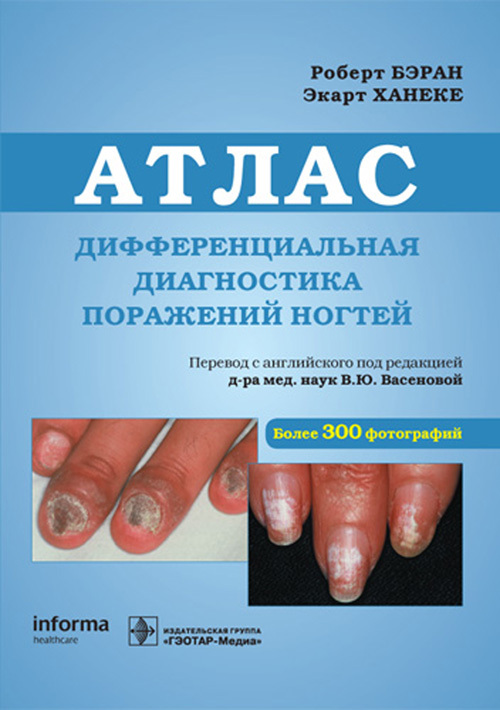 

Дифференциальная диагностика поражений ногтей. Атлас