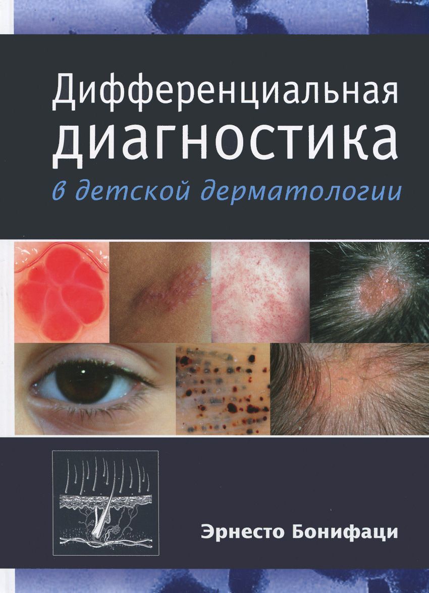 

Дифференциальная диагностика в детской дерматологии (880541)