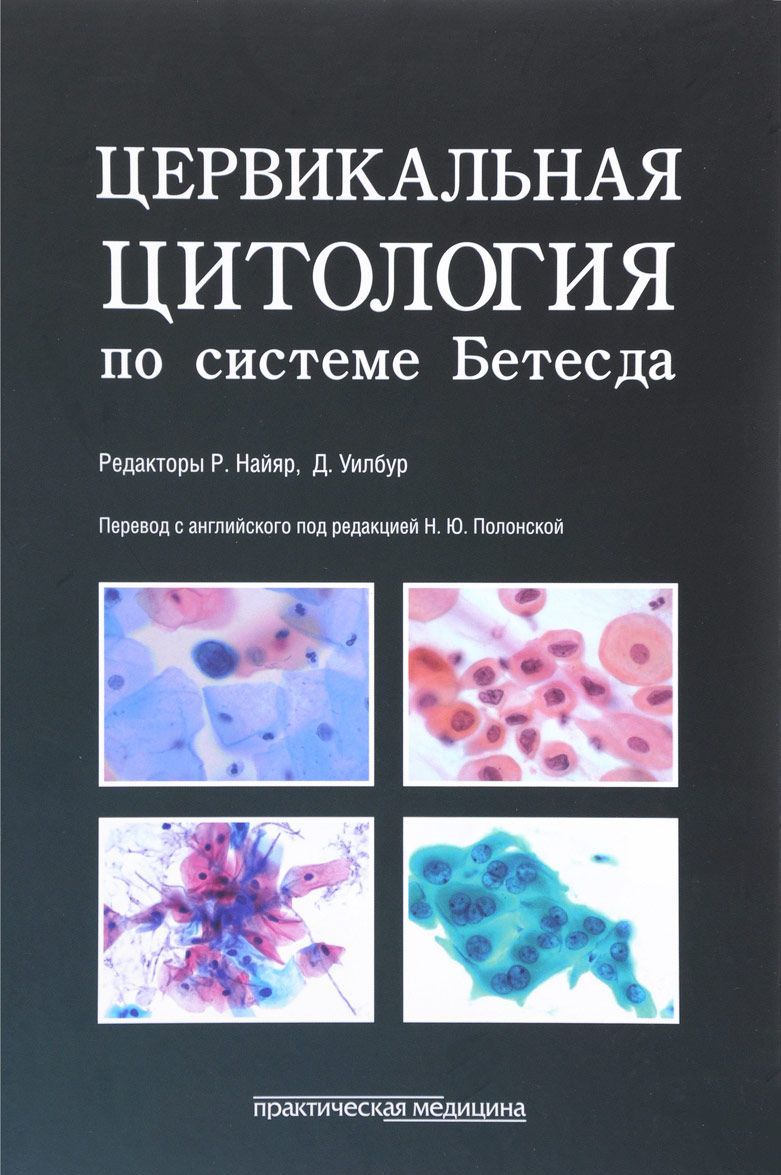 

Цервикальная цитология по системе Бетесда. Терминология, критерии и пояснения (1669272)