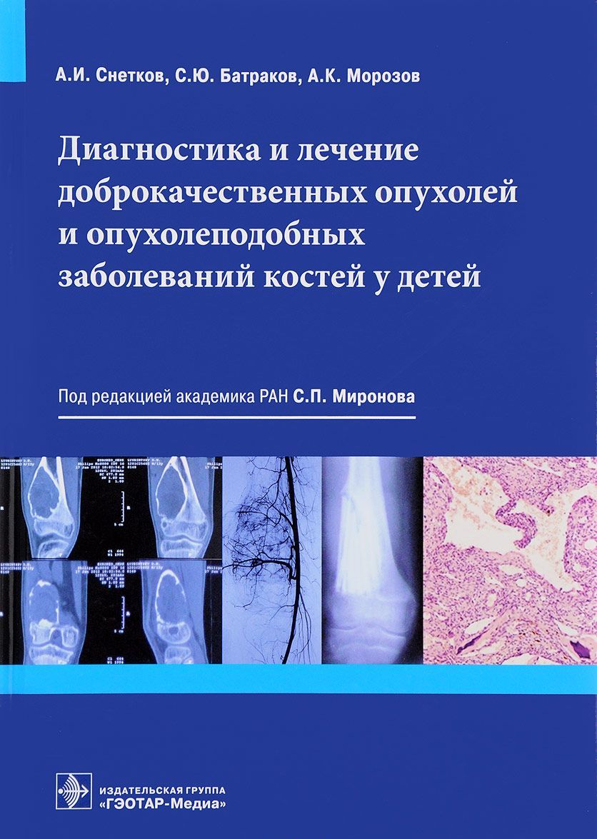 

Диагностика и лечение доброкачественных опухолей и опухолеподобных заболеваний костей у детей