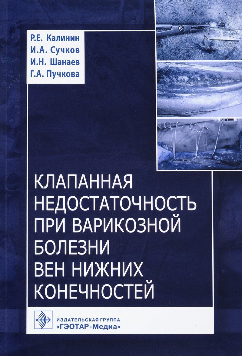 

Клапанная недостаточность при варикозной болезни вен нижних конечностей