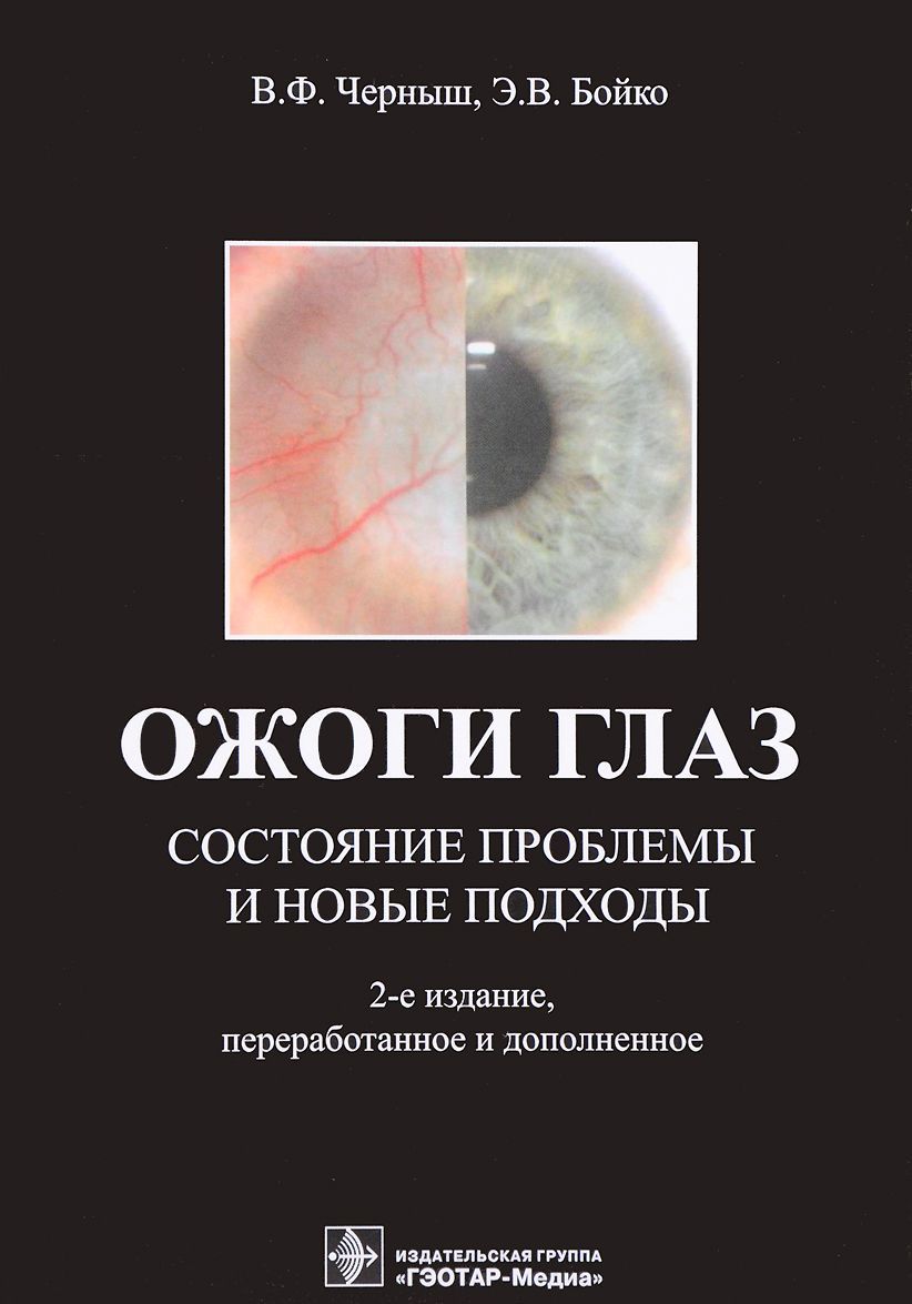 

Ожоги глаз. Состояние проблемы и новые подходы