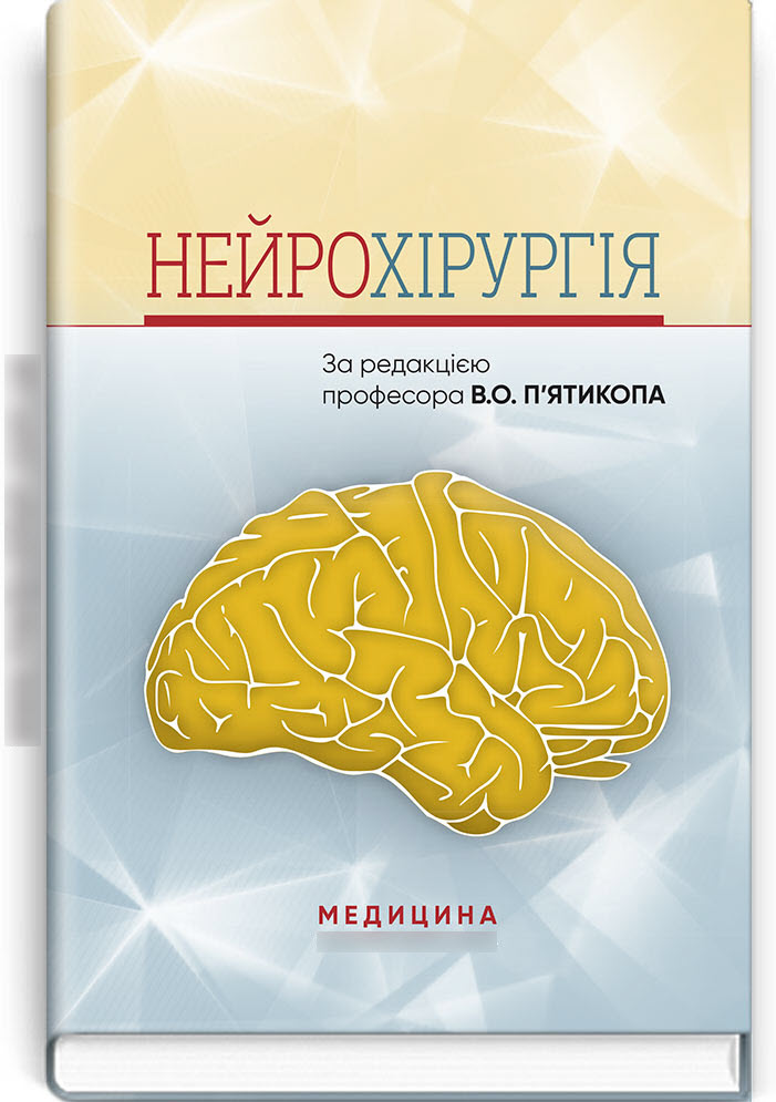

Нейрохірургія
