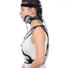 Корсет-воротник Минерва для жесткой фиксации шейного и грудного отделов позвоночника Ersamed ERS-116 L - изображение 3