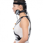 Корсет-воротник Минерва для жесткой фиксации шейного и грудного отделов позвоночника - Ersamed ERS-116, Белый (L) - изображение 3