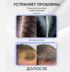 Дарсонваль косметологический для ухода за кожей лица волос и тела MASHELE BROM Darsonval YL-D04 газ Ar+Ne - изображение 10