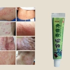 Китайский бальзам Hmong Balm - лучшее средство от проблем кожи (псориаз, дерматит, грибковых инфекций, акне), 15 г - изображение 3