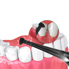 Ультразвуковой зубной скалер для удаления зубного камня для дома - изображение 5