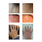 Прибор UVB-311 9W, ручной для лечения заболевания кожи (927901700121) - изображение 6