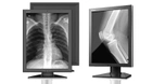 Діагностичний медичний монітор JUSHA-M260G (2МП, монохромний, діагональ 21,3 дюйми, для рентгенографії, МРТ, КТ, ангіографії) - зображення 1