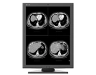 Діагностичний медичний монітор JUSHA-M260G (2МП, монохромний, діагональ 21,3 дюйми, для рентгенографії, МРТ, КТ, ангіографії) - зображення 2