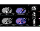 Клінічний медичний монітор JUSHA-CR22 (2МП, кольоровий, діагональ 21,5 дюйми, CT, MR, PET, PACS, ультразвук) - зображення 6