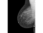 Мамографічний медичний монітор JUSHA-M53 (5МП, монохромний, діагональ 21,3 дюйми, для рентгенографії, мамографії, МРТ, КТ, ангіографії) - зображення 8