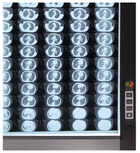 Світлодіодний медичний негатоскоп ZG-2D - изображение 2