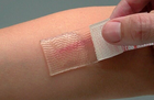Силиконовый гелевый пластырь для лечения шрамов и рубцов CICA-CARE (12x15 см) - изображение 4