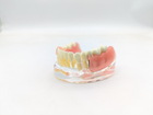 Модель стоматологічна імплантація та знімне протезування фантом - зображення 2