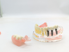 Модель стоматологічна імплантація та знімне протезування фантом - зображення 4