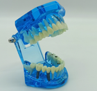 Стоматологічна модель із зубами карієсом імплантом періодонтитом каменем колір синій - зображення 1