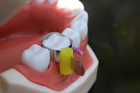 Стоматологічні матриці для жувальної групи зубів 50шт Super Mat - зображення 6