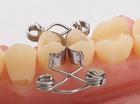 BESTSELLER Набор из 25 зубных матриц Walser® с щипцами и лотком для стерилизации. - изображение 3