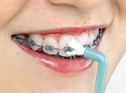 Зубна щітка Curaprox Single & Sulcular CS 1009 монопучкова 9 мм (7612412100907) - зображення 4