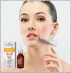Peeling kwasowy do twarzy Floslek Dermo Expert White & Beauty 30 ml (5905043005423) - obraz 6