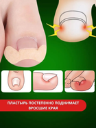 Набір пластирів 50шт від врослих нігтів для корекції та усунення врослих нігтів Elastic Toenail Correction Sticker - зображення 3