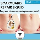 Гель против шрамов и рубцов Scarguard Scar Repair Liquid с витамином Е (15 мл) - изображение 10