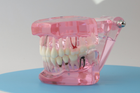 Модель стоматологічна демонстраційна (розбірна) рожева - зображення 7