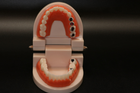 Модель демонстраційна стоматологічна з патологіями - зображення 3