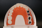 Модель демонстраційна стоматологічна з патологіями - зображення 4